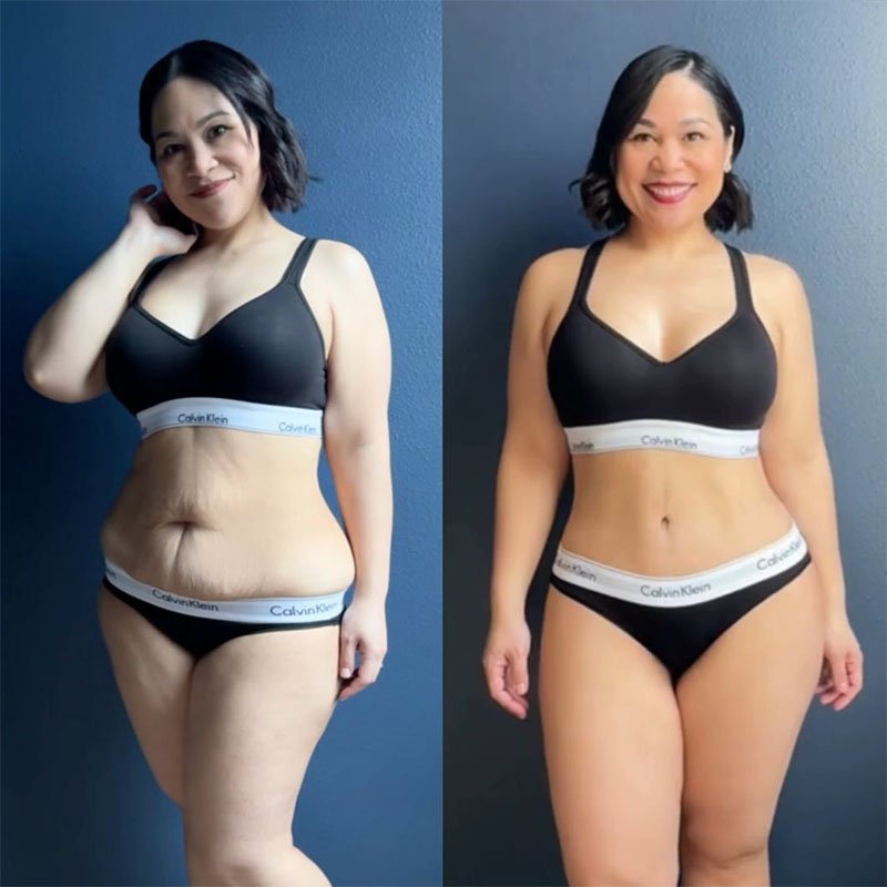 Sculpify™ SlimSculpt Device - Target Fat. Tone Fast.